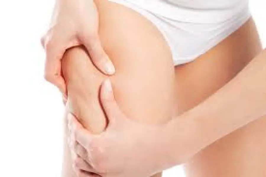Come si forma la cellulite