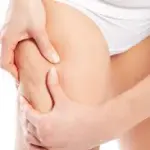 Come si forma la cellulite
